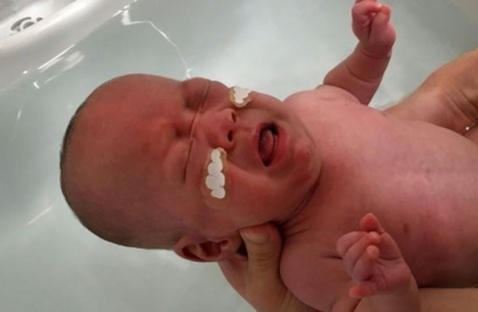 El bebé más pequeño del mundo es de Japón: pesó 268 gramos al nacer y ya fue dado de alta