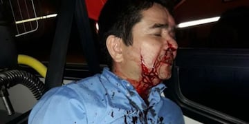 Chofer agredido por delincuentes