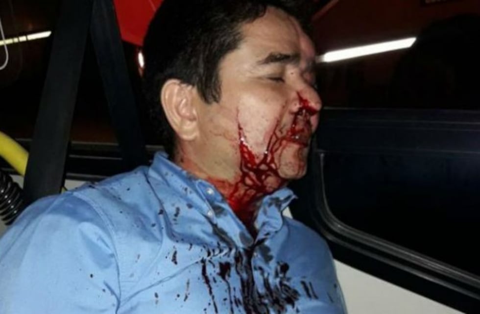 Salvaje agresión a un colectivero de Ersa