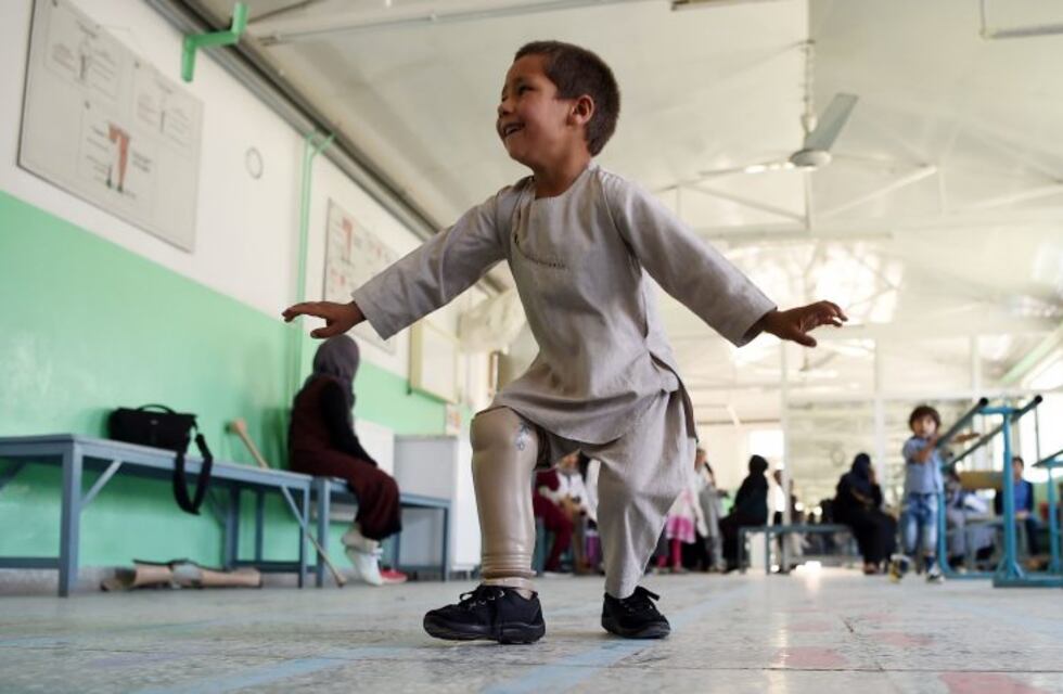 El emotivo video de un niño afgano de cinco años bailando feliz con su nueva pierna