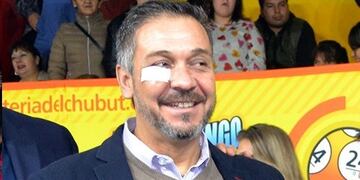 Barbato el domingo pasado en Corcovado, con un apósito en su ojo derecho\u002E