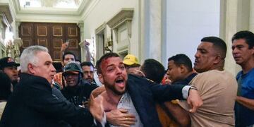 TOPSHOT - An opposition deputy struggles while pro-government supporters force their way to the National Assembly during an extraoridinary session called by opposition leaders, in Caracas on October 23, 2016.nVenezuela's opposition-majority legislature declared Sunday that President Nicolas Maduro's