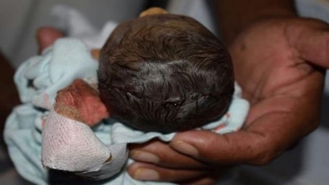 La madre dio a luz en la ambulancia que la trasladaba al hospital\u002E Imagen ilustrativa\u002E