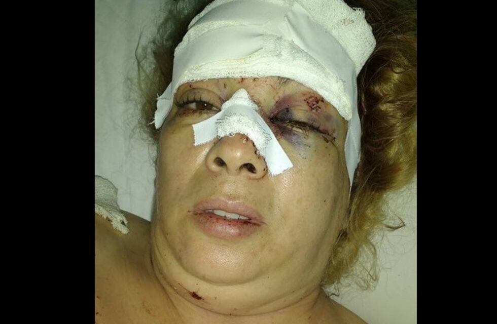 La pasajera que se salvó en el accidente donde murió un taxista publicó fotos de su estado