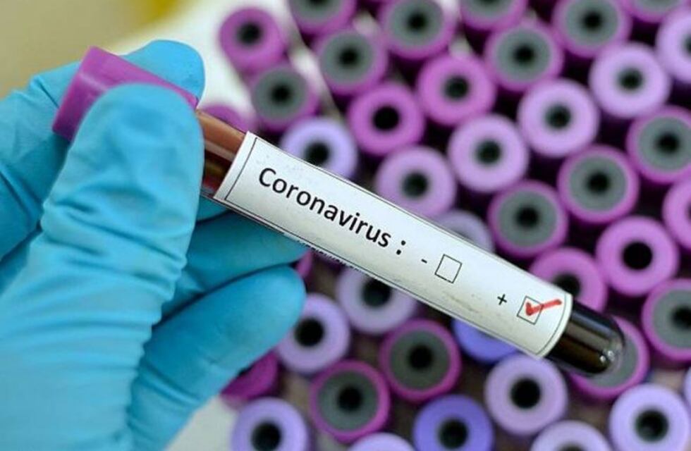 Coronavirus: De los 41 nuevos casos en el país, Chaco sumó 7