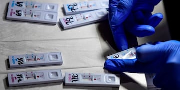 Entre Ríos reportó 22 nuevos casos de COVID-19\u002E\nCrédito: AFP