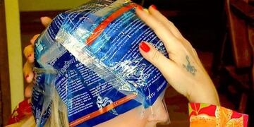 El frío congela los folículos capilares e impide que el efecto de la quimioterapia los debilite\u002E