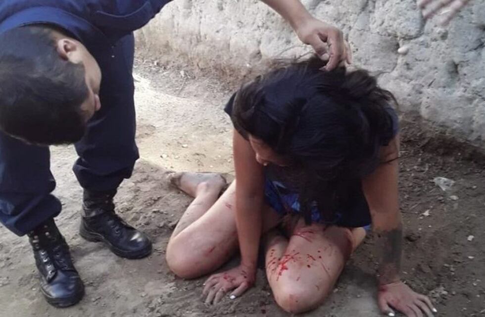 San Juan: salvan a una mujer de que su ex la mate a palazos