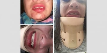 Mujer golpeada\u002E