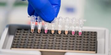 Yellow coloured coronavirus Covid-19 positive samples are seen, as Viennese research institutes and the Agency for Health and Food Security (AGES) present a new coronavirus Covid-19 test method called \