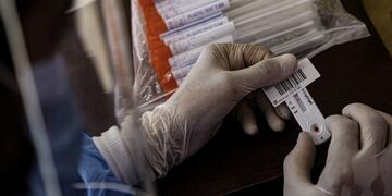 16 June 2020, Egypt, Cairo: A health worker holds swab samples collected from people at a drive-through coronavirus (COVID-19) testing unit inside the parking lot of Ain Shams University Specialized Hospital\u002E Egypt has set up its first drive-through coronavirus testing centre in an effort to make it easier for people to get tested amid the spread of the coronavirus pandemic\u002E Photo: Adel Eissa/dpa