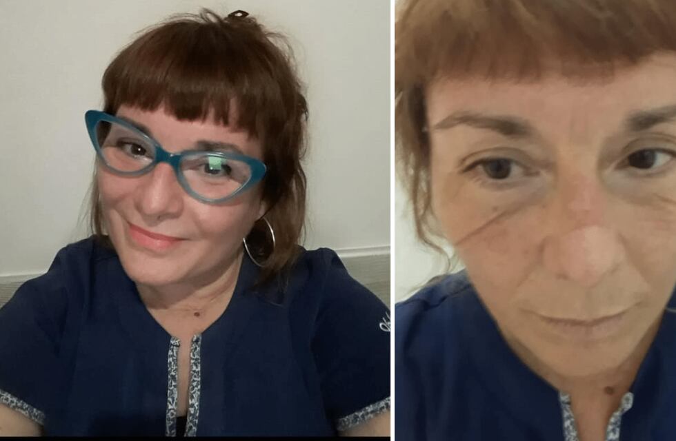 Impactante: el antes y después de una médica olavarriense tras un día de guardia