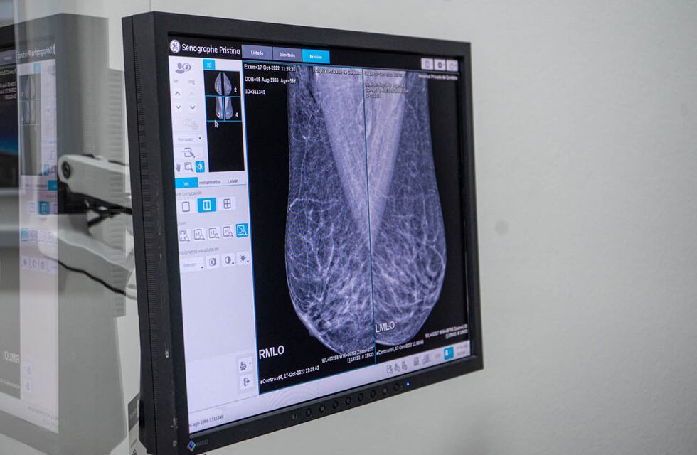 Comienza la 14° campaña de detección precoz del Cáncer de Mamas