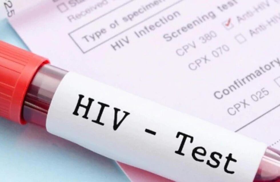 "Al menos un 17% de quienes tienen VIH lo ignoran", advierten especialistas