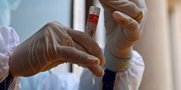 A health worker holds a nasal swab sample to be tested for COVID-19 coronavirus at a testing centre in Srinagar on July 17, 2020\u002E - EU leaders met face to face on July 17 to try to rescue Europe's economy from the ravages of the coronavirus pandemic, as India became the third country to record one million cases, joining Brazil and the United States\u002E (Photo by TAUSEEF MUSTAFA / AFP)