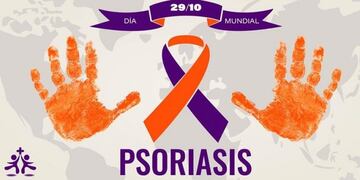 Inicia la campaña de detección de pacientes con psoriasis a nivel nacional y en las provincias\u002E (Web)\u002E