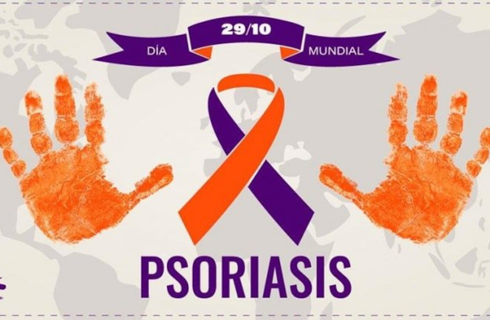 Inicia la campaña de detección de pacientes con psoriasis a nivel nacional y en las provincias