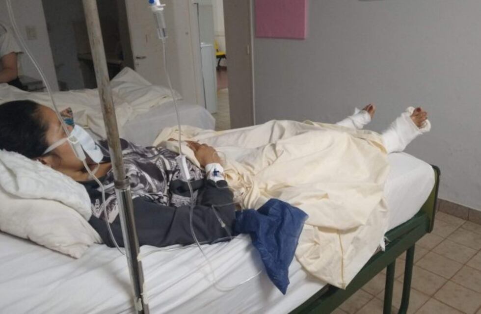 La mujer herida con machete en Iguazú dijo que no es la primera vez que su expareja la quiere matar