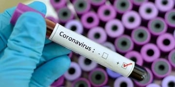 Un nuevo caso de coronavirus confirmado en Córdoba\u002E
