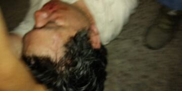 Hombre es linchado en Libertador por acoso a una niña de 13 años