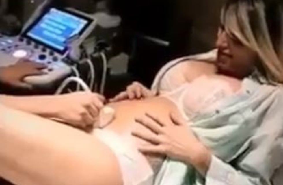 Vicky Xipolitakis reveló la carita de su bebé con una ecografía 4D