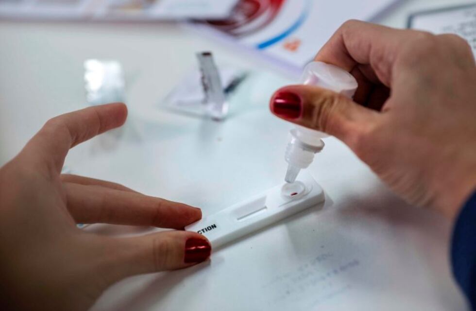 Profesionales de la salud se capacitaron en diagnóstico de VIH, sífilis y hepatitis