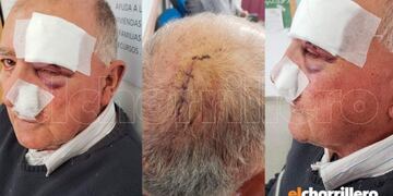 Así dejaron a Ricardo Camargo luego de asaltarlo\u002E