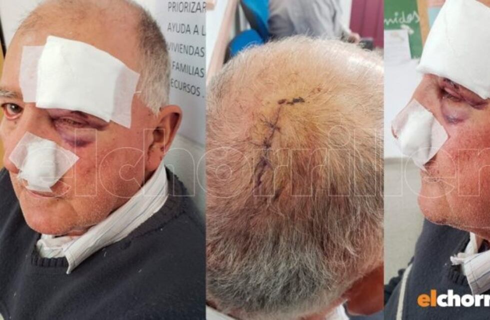 Detuvieron a uno de los tres delincuentes que atacaron a un jubilado en San Luis