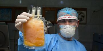 An Iraqi phlebotomist holds a bag of plasma donated by a recovered COVID-19 patient at the blood bank of Iraq's southern city of Nasiriyah in Dhi Qar province, on June 24, 2020\u002E (Photo by Asaad NIAZI / AFP)
