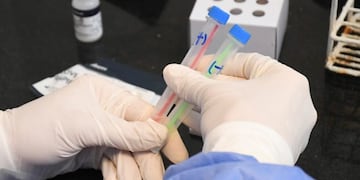 Otros tres fallecidos por Covid en La Pampa (APN)