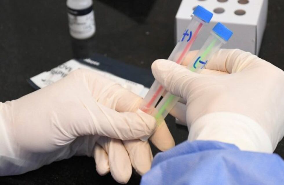 Fallecieron tres pacientes con coronavirus en La Pampa y ya son 44 decesos
