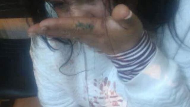 Lorena denunció haber sido atacada por su ex pareja el martes por la tarde en Pérez\u002E