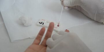 Campaña de detección en la semana de lucha contra la hepatitis\u002E (CIMECO)