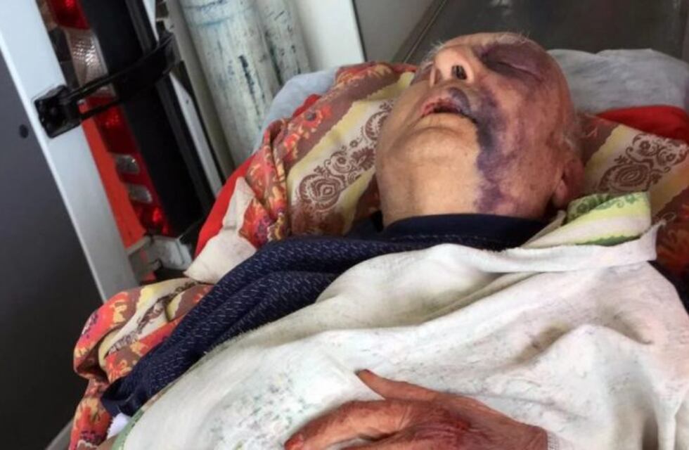 Asaltaron a un jubilado de 92 años al que golpearon y maniataron para robarle sus ahorros