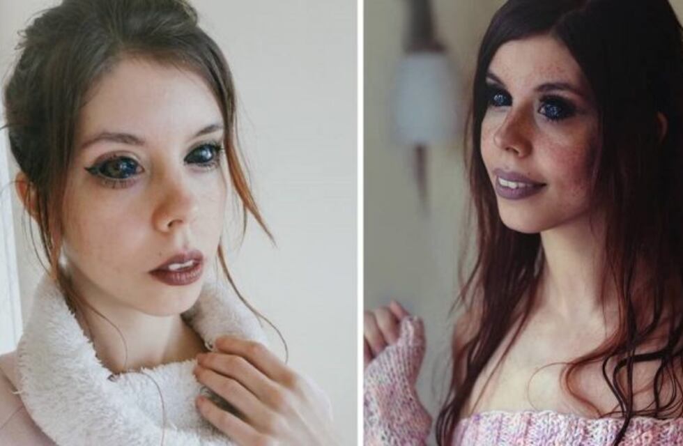 Insólito: una influencer polaca se tatuó los ojos y quedó ciega
