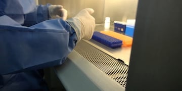 El equipo de Biología Molecular diariamente realiza análisis de muestras para confirmar o descartar el diagnóstico de coronavirus\u002E