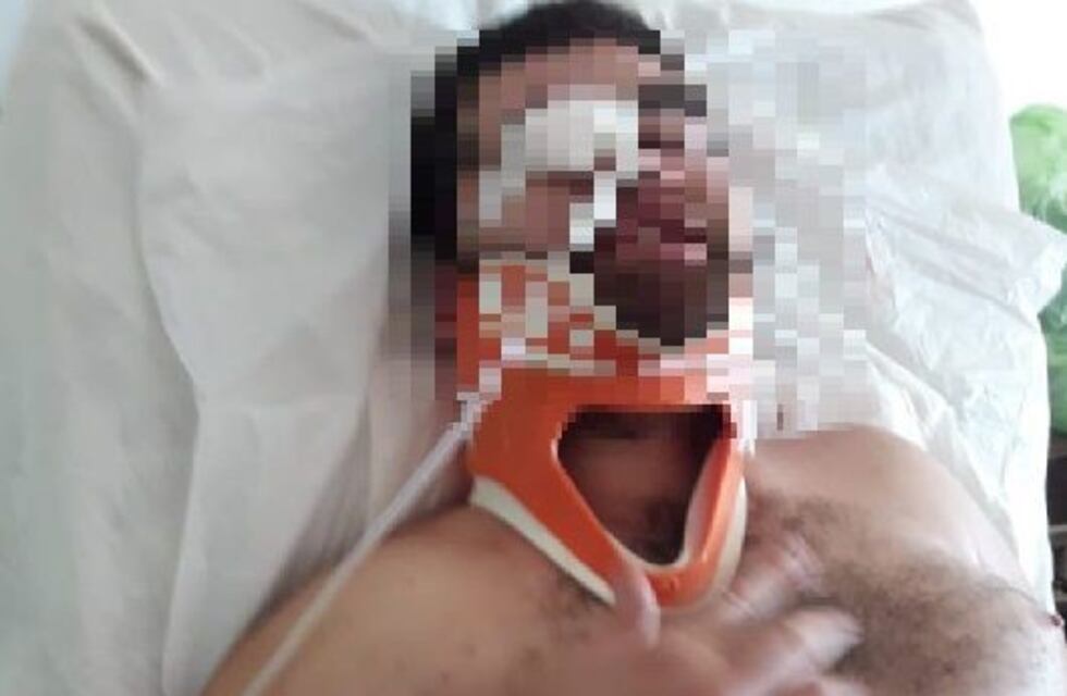 Llegaron al hospital con heridas de armas de fuego y denunciaron que fueron asaltados