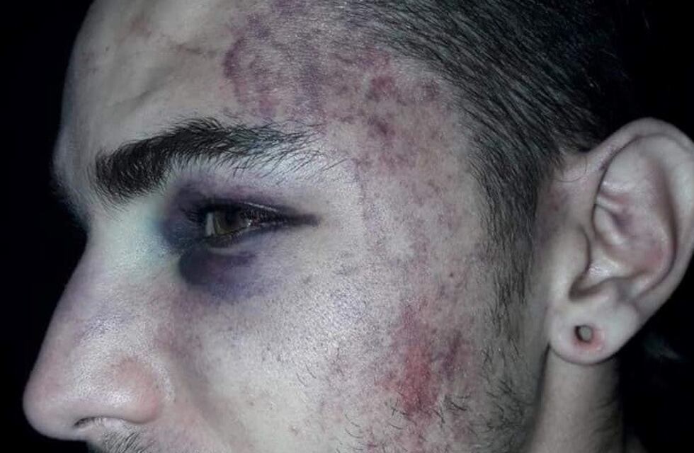 Jóvenes denunciaron haber sido brutalmente agredidos por la policía
