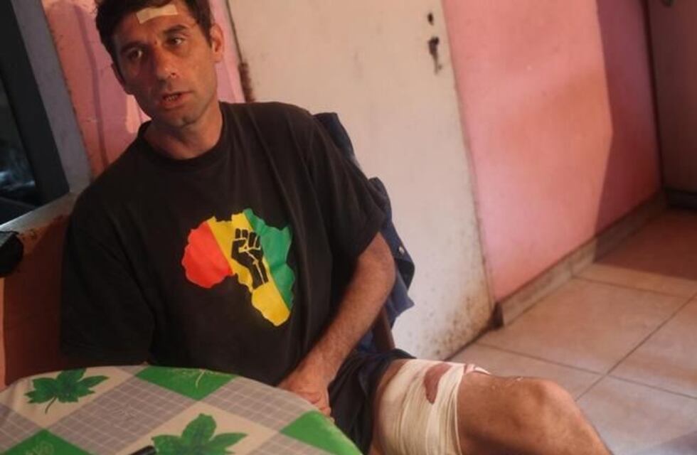 La Plata: Fue baleado al enfrentar a un ladrón que quiso robarle el auto