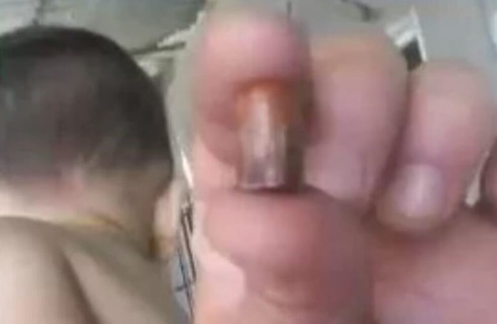 La Tablada: creyeron que un perro había mordido a su bebé, pero tenía una bala en la pierna