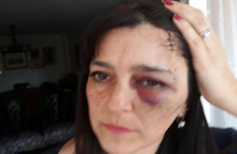La mujer del conductor acusado de agredir con un machete dijo que su pareja salió en su defensa