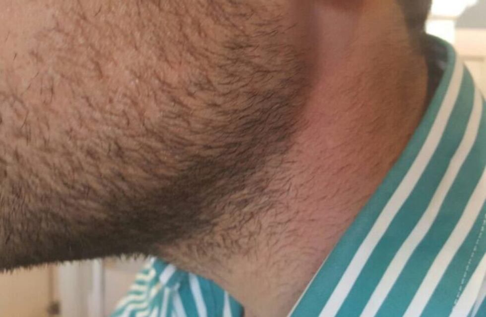 Un dirigente del PRO denunció que intentaron estrangularlo