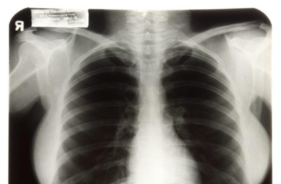 Coronavirus: dos estudiantes cordobeses crearon un sistema de detección con radiografías