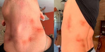 El hombre muestra las marcas que los policías le abrían ocasionado al golpearlo\u002E (Foto: gentileza ElDoce\u002Etv)\u002E