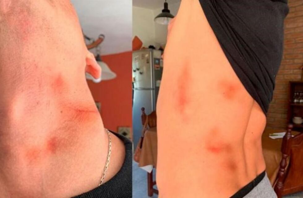 Carlos Paz: fue imputado por escapar de un control pero denuncia que fue golpeado por policías