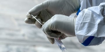 A health worker puts a swab sample in a tube test after collecting it from a patient for a Covid-19 coronavirus PCR test, in Kathmandu on August 28, 2020\u002E (Photo by PRAKASH MATHEMA / AFP)