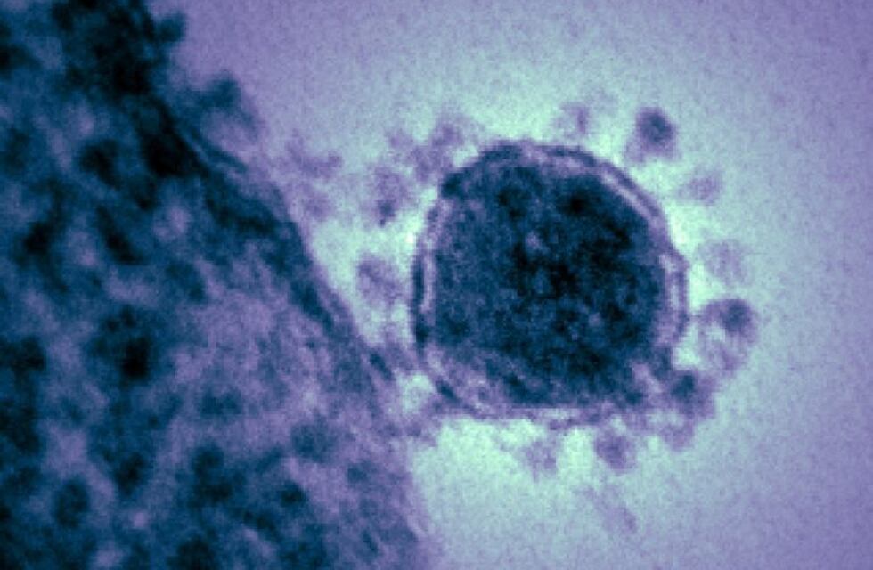 Primer caso confirmado de Coronavirus en La Calera