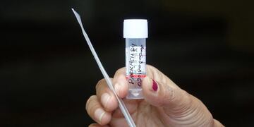 covid positivo en El Hoyo\u002E