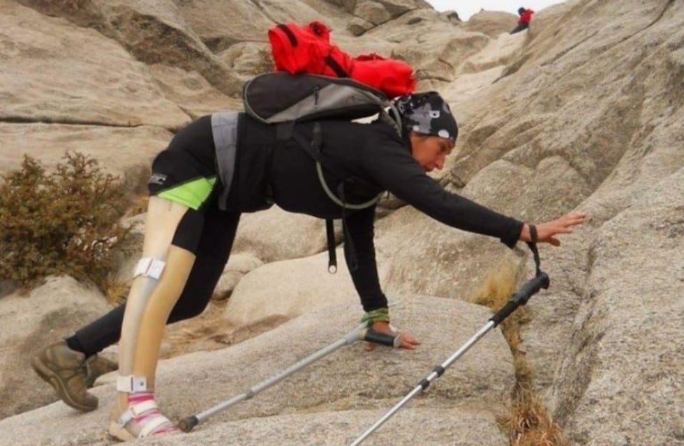 La conmovedora historia de Andrea: le querían amputar la pierna pero se negó y hoy escala montañas