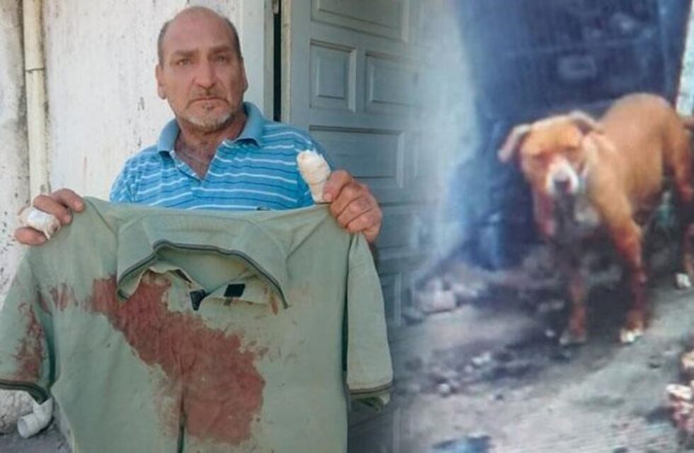 Un perro le destroza la cara a una beba de 20 meses